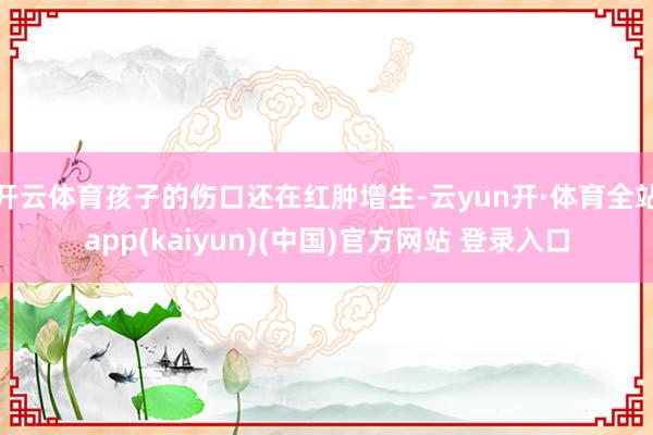 开云体育孩子的伤口还在红肿增生-云yun开·体育全站app(kaiyun)(中国)官方网站 登录入口
